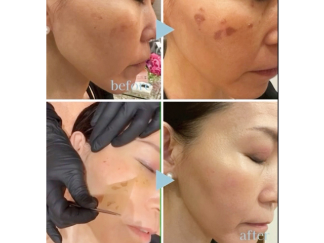 ＬＡＮＩＨＡＮＡ -ラニハナ-