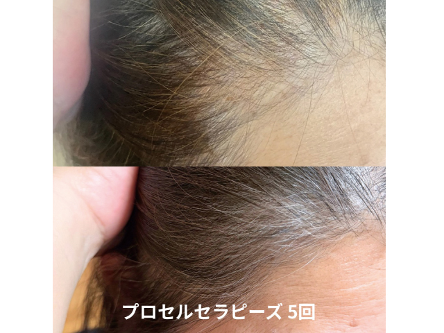 薄毛改善サロン　Lumor